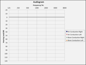 Blank Audiogram Chart