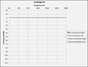 Blank Audiogram Chart