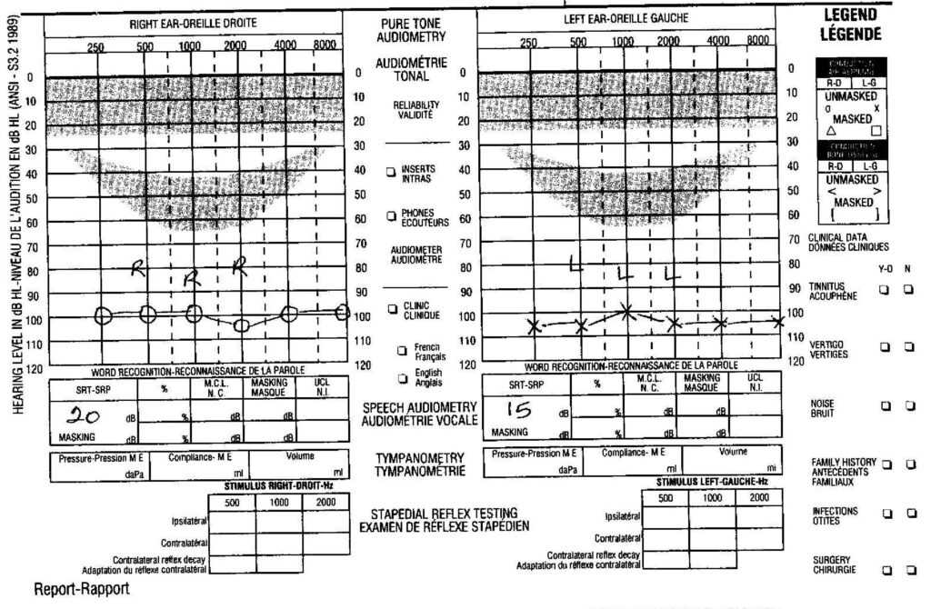 Blank Audiogram Template Download | Atlantaauctionco.com