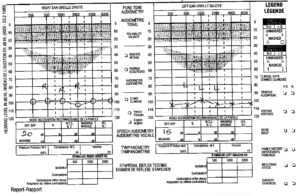 Audiogram Chart Templates