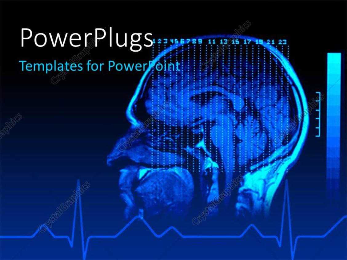 Powerpoint Template: A Side View Of An X Ray Human Head (4013) Throughout Radiology Powerpoint Template