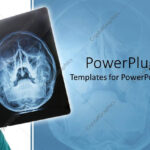 Powerpoint Template: Hand Holding Up X Ray Scan Of Human Pertaining To Radiology Powerpoint Template