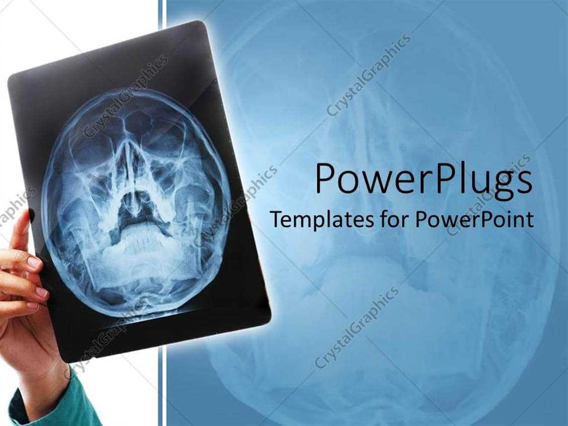 Powerpoint Template: Hand Holding Up X Ray Scan Of Human Pertaining To Radiology Powerpoint Template